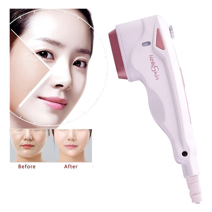 Maquina Rejuvenecimiento Facial Radiofrecuencia Anti Arrugas