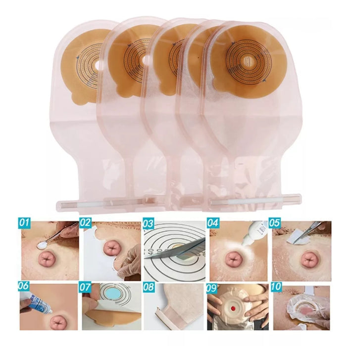 10x Bolsa Colostomia Placa Aro Ostomia 65mm Anti Olor Gases