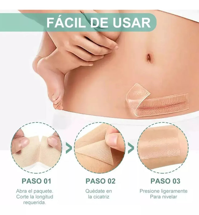 Rollo Cinta Elimina Cicatrices Queloides Silicona 4cmx1.5mts